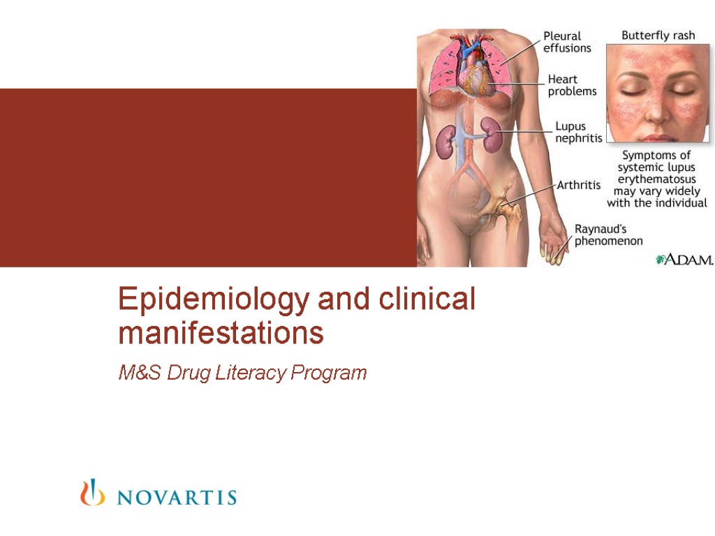 M&S Drug Literacy Program Epidemiology and clinical manifestations
